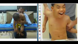 ABR Facts Case Study 9 Jared athetoid cerebral palsy [upl. by Annahsohs253]