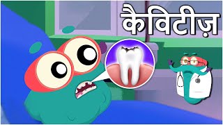 कैविटीज़  दांतों में कीड़े  Cavities In Hindi  DrBinocs Show  Educational Videos For Kids [upl. by Vinson]