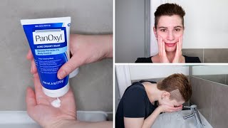 How to use PanOxyl 4 Benzoyl Peroxide Acne Creamy Wash [upl. by Repmek]