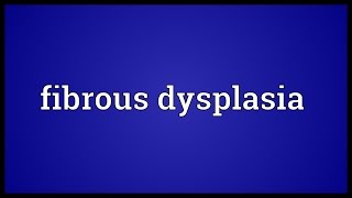 Fibrous dysplasia Meaning [upl. by Ericha]