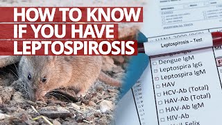 How to know if you have Leptospirosis Lifesaver [upl. by Oam838]