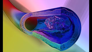 Galectin3 binds the Transferrin Receptor amp Kills TCells  Failed Biochemist Season 2020 ep 61 [upl. by Eelaroc]