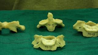 Vertebrae  How to differentiate them [upl. by Lyford513]