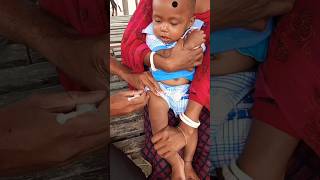 baby injection crying video shorts viral trending [upl. by Akcemat]