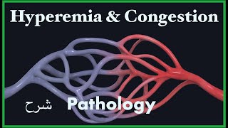 Pathology  Congestion amp Hyperemia  Hemodynamic blood disorders 3 شرح باثو [upl. by Nnywg]