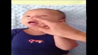 Criggler Lacrimal Massage for treatment of Blocked Tear ducts in Infants [upl. by Adnamra555]