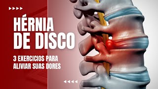 HERNIA DISCAL  3 Exercícios que ajudam aliviar as dores [upl. by Airod]