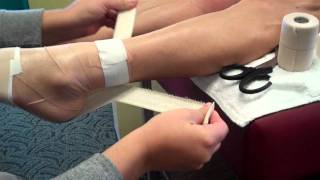 Taping for Achilles Tendinitis [upl. by Gilchrist667]