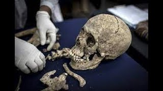 Antropología Forense  Análisis e identificación de restos humanos [upl. by Di]