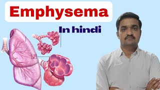 Emphysema in hindi  cause type pathology symptoms  nursing class  Bsc nursing  COPD [upl. by Nossaj]