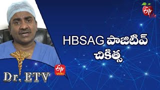 Hbsag Positive  Treatment  Hbsag పాజిటివ్ – చికిత్స  DrETV  2nd June 2022  ETV Life [upl. by Enomas634]