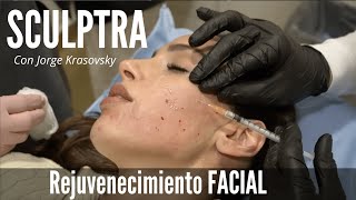 SCULPTRA Antes y Después  Lo último en Rejuvenecimiento Facial con el Dr Jorge Krasovsky [upl. by Notlehs]