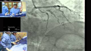 Part 1 Complex PCI Case  Patient Presentation and Access [upl. by Haldis]