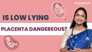 Can Low Lying Placenta Harm Your Fetus  She The People [upl. by Atiruam]