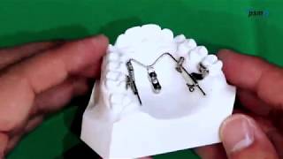 PSM  BENEfit Bending a Beneslider acc Dr S Yamaguchi  Tutorial [upl. by Netloc]