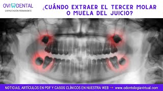 ► PERICORONARITIS ¿Cuándo extraer el tercer molar o muela del juicio [upl. by Nyladnor]