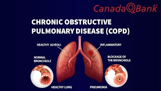 Chronic Obstructive Pulmonary Disease COPD [upl. by Yntruoc]