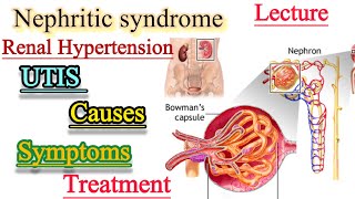 Nephritic syndromeUrinary Tract infectionsRenal Hypertensioncauses SymptomsTreatment [upl. by Nika661]