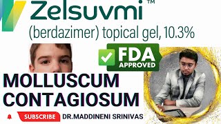 BERDAZIMER Topical gel 103  MOLLUSCUM CONTAGIOSUM Treatment update  Latest FDA Approved Drug [upl. by Avraham]