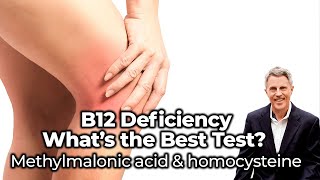 B12 Deficiency  what’s the best test Methylmalonic acid amp homocysteine  FORD BREWER MD MPH [upl. by Ariaj]