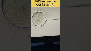 ICSI Procedure in IVF Intracytoplasmic sperm injection fertilitytreatment ivfjourney ivfsuccess [upl. by Emsoc]