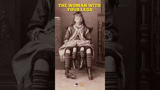 The Woman With 4 Legs [upl. by York]