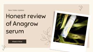 Anagrow Serum Review  Jenpharm  Review by Foodie n The Xplorer [upl. by Chipman88]