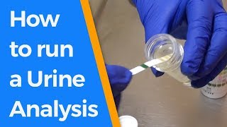 How to run a Urine Analysis [upl. by Theodoric]