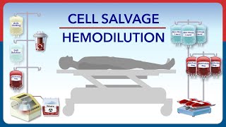 Cell Salvage and Hemodilution [upl. by Krute]