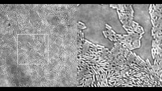 Pseudomonas twitching motilitythe closeup [upl. by On800]