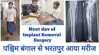 Tibia bone implant Remove after fracture full Recovery টিবিয়া হাড় ইমপ্লান্ট পুনরুদ্ধারের পরে সরান [upl. by Aivatnohs]