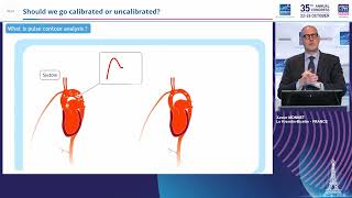 Xavier Monnet  Pulse contour analysis Should we go calibrated or uncalibrated [upl. by Lydie]