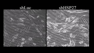 Knocking down of heatshock protein 27 directs differentiation of functional glutamatergic neurons [upl. by Clardy903]