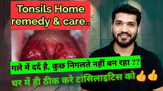 टॉन्सिलाइटिस घरेलू उपचार  Tonsillitis Home Remedies and care [upl. by Esina]