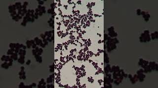 Gram Staining Insights Identifying Staphylococcus hominis as GPC in Singles Pairs and Clusters [upl. by Lodie]