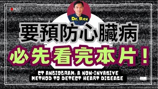 檢查心臟之前必須搞清楚的幾件事！ct angiogram  something I wish I knew before the test [upl. by Ivor]