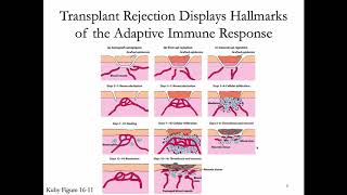 Immunology Lecture 32 Transplantation Immunology [upl. by Other]