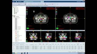 Tutorial 6 Plan Analysis in Eclipse [upl. by Khichabia]