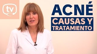 Causas y tratamiento del acné [upl. by Nahtnhoj58]