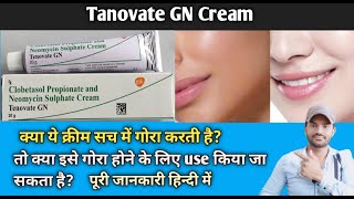 Tenovate GN Cream use benefits and Side effects full review in hindi [upl. by Catlin]