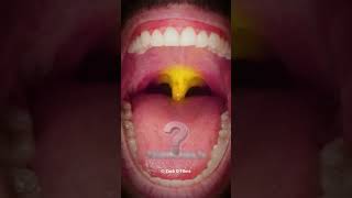 Your Oral Health Affects Your Entire Body Mouth Bell [upl. by Ojimmas750]