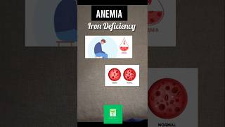 Acupressure points for anemia  Iron Deficiency Anemia acupressure anemia iron shorts [upl. by Wetzell]