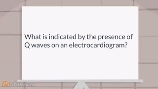 What is indicated by the presence of Q waves on an EKG [upl. by Sheffield]