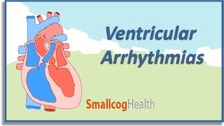 Ventricular Arrhythmias [upl. by Eckhardt]