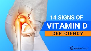 14 Signs and Complications of Vitamin D Deficiency [upl. by Terri]