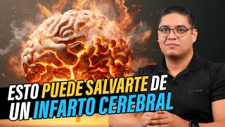 ESTO PUEDE SALVARTE DE UN INFARTO CEREBRAL [upl. by Elita]