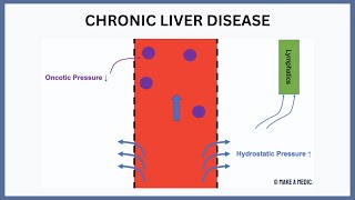 Chronic Liver Disease Explained [upl. by Desai588]