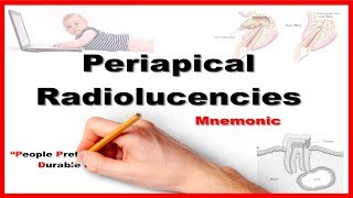 Periapical Radiolucencies  Mnemonic Series  23 [upl. by Upshaw755]