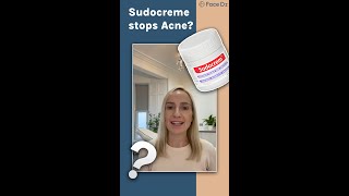 Does Sudocrem clear Acne [upl. by Conrado]