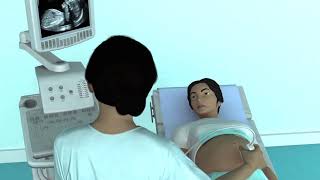 The Basic Steps of an Obstetric Ultrasound Examination [upl. by Enileda]